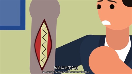 【基金会系列】3760 | 黑色眼睛：当你拥有一条鲨鱼的手臂