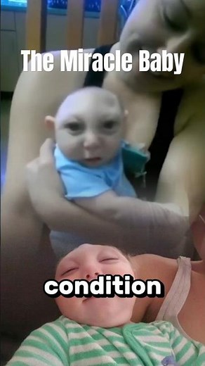 Baby Born Without a Brain: Jaxon’s Story