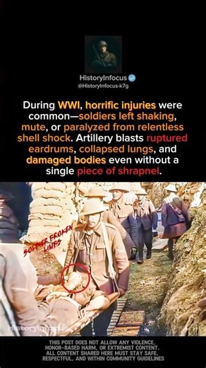 The Horrific Injuries of WWI: The Dark Reality Hidden by History #history #shorts #historyshorts