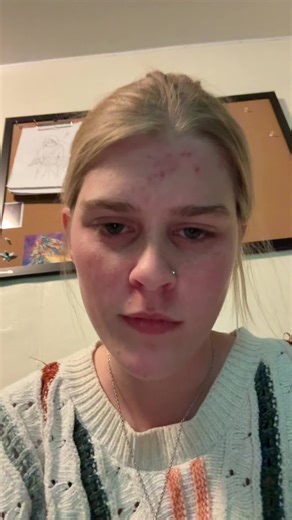 Understanding Hyperfixation: A Deep Dive