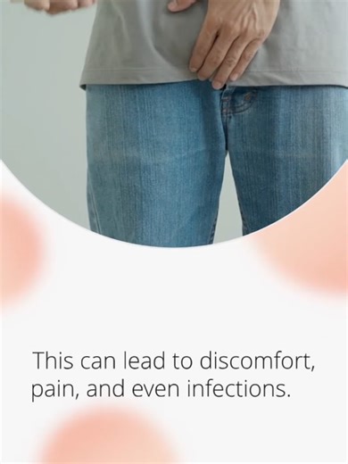 Cómo estirar el prepucio: guía sobre fimosis