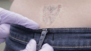 Learn How PicoWay Laser Is Different From Traditional Tattoo Removal