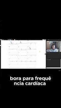 Como Definir o Ritmo Sinusal e Calcular a Frequencia cardiaca?