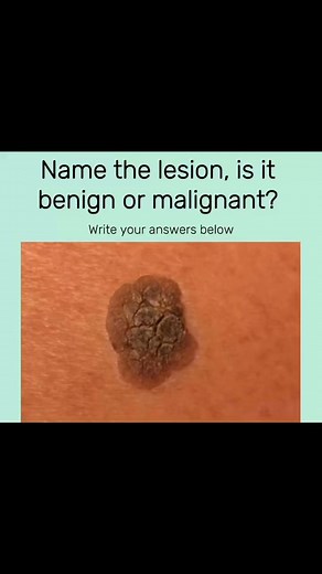 #dermatology#derm#medicine | Medical Education