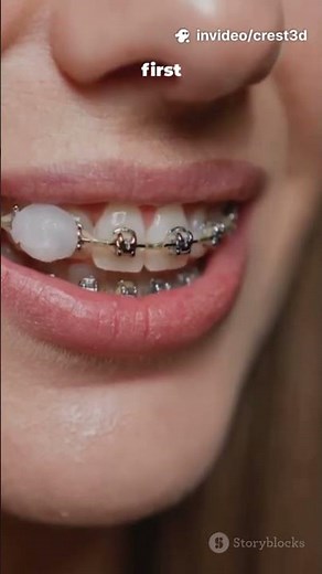 Say Goodbye to Yellow Teeth! 👋✨ Crest 3D Whitestrips Amazon Review