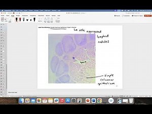 Identification of Peyer's Patches