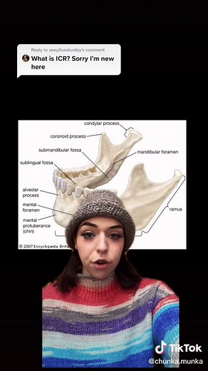 Reply to @seey0usaturday Here’s what you’ve missed if you’re new! #fyp #idiopathiccondylarresorption