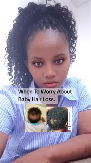 When to Seek Help for Baby Hair Loss