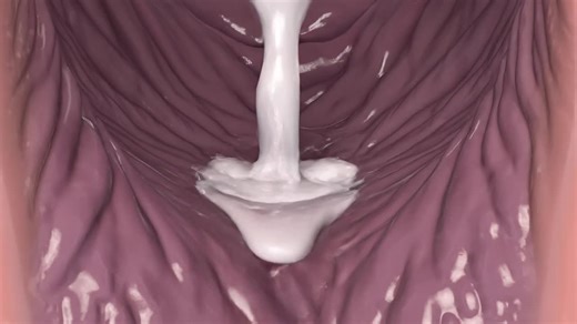 Understanding the White Discharge During Menstruation