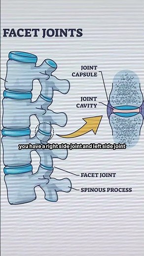 Does Your Neck Pain Cause Headaches? 🤯 | Facet Joint Arthritis Symptoms
