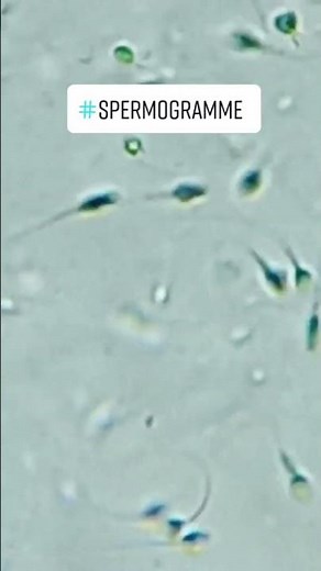 Did you know sperm can be seen in a microscope? #shorts