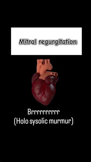 Heart sounds #veterinarymedicine #vetstudent #heartsounds #heartdisease