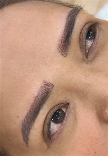 Brow Correction and Reshaping Techniques