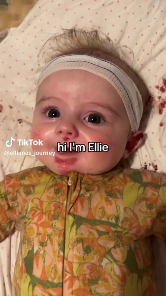 Butterfly Baby: Understanding Epidermolysis Bullosa