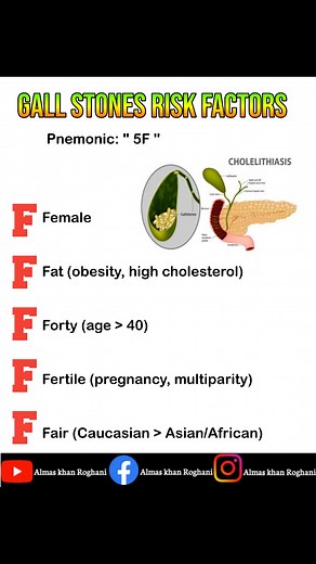 Risk factors for gall stones | Almas Khan Roghani