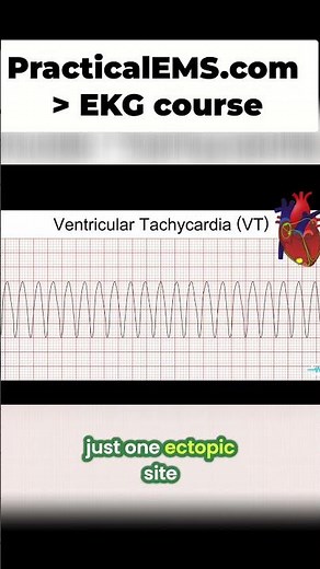 EKG Rhythms: Unlocking Secrets of Idioventricular & Ventricular Tachycardia! #shorts