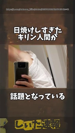 日焼けしすぎたキリン人間 #twitter #ツイート #話題 #日焼け #キリン #自撮り