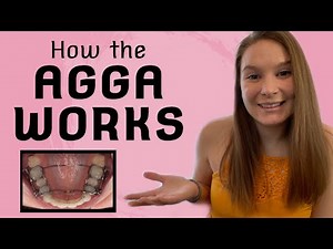 How AGGA Works | AGGA Appliance Explained