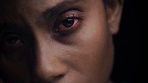 Horizon Therapeutics TV Spot, 'Graves Disease: Learn More'