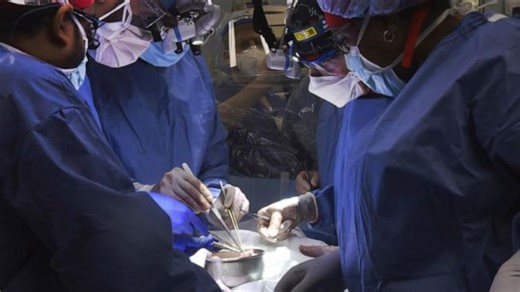 Doctors say they’ve transplanted a pig heart into a human patient