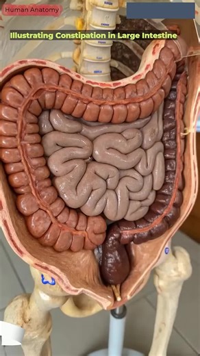 Constipation Awareness: Understanding Digestive Health