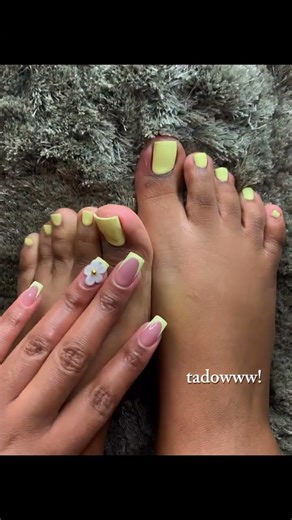 pretty yellow pedi #pedicure