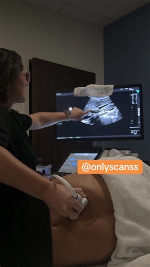 Biliary tree #Ultrasound #Sonography #ultrasoundtech #sonographystudent #educational