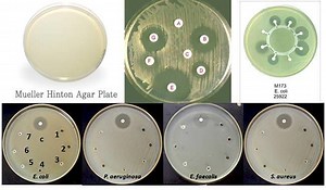 Mueller Hinton agar - Alchetron, The Free Social Encyclopedia