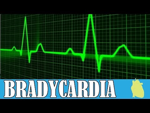 Bradycardia | Causes | Symptoms #anaesthesia #medicalstudent #medical #medicines