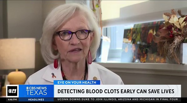 Detecting blood clots early can save lives