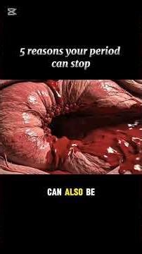 5 Reasons your period can stop flowing