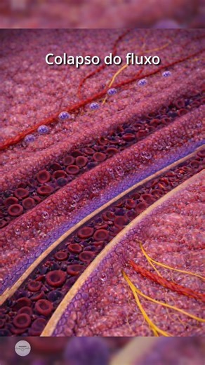 Quando a polpa entra em colapso… não tem mais volta 🦷