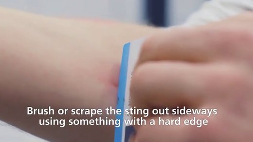 NHS warning as cases of BLOODSUCKING flies which cause BLISTERS RISE