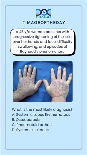 👉 What is the most likely diagnosis?