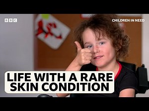 Supporting Pippa through her rare skin condition