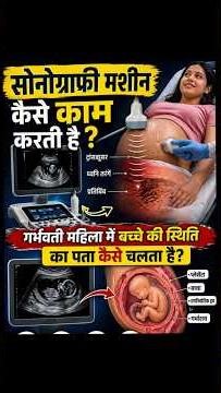 What is sonography (ultrasound)? How does this machine work? #3d #ultrasound #science.