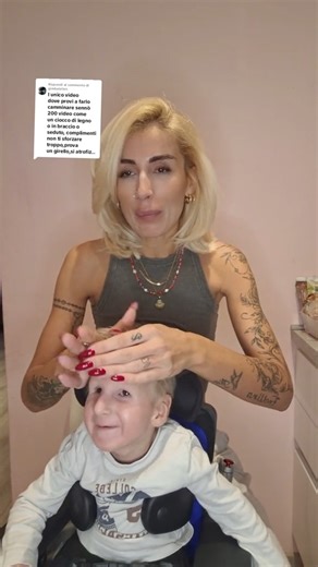 11K views · 641 reactions | Risposta a @gimbalalien #cockaynesyndromeawareness #cockayne #syndrom | Roberto Giada | Facebook