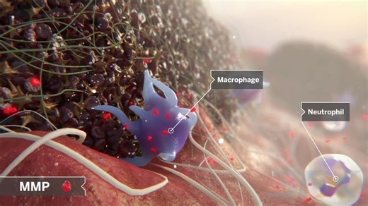 Medical Animation on Instagram: "3FX (@3fxanimation) created a dynamic mechanism of action animation for Organogenesis, visually demonstrating how their regenerative medicine therapies work at the cellular level to support healing and tissue repair. Explore more work by 3FX on the Medical Illustration & Animation Sourcebook online site. Link in bio. #3fx #organogenesis #moaanimation #mechanismofaction #medicalanimation #regenerativemedicine #visualmedicine #healthcareanimation #cellularbiology #
