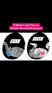 377K views · 5.2K reactions | 12 Week's nub Theory Gender Reveal ultrasound scan | Dr.aneela manzoor-RPH | Facebook