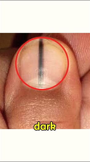 Don't Ignore This Line On Your Nail‼️
