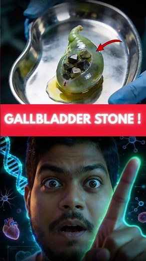 How Doctors Remove the Gallbladder 😱 | Laparoscopic Surgery Explained