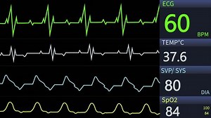 clip-3580652419-animated-video-patient-monitor-screen-displaying-vital