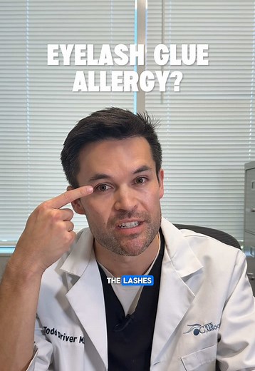 Eyelash Glue Allergy: Causes, Symptoms & What to Do