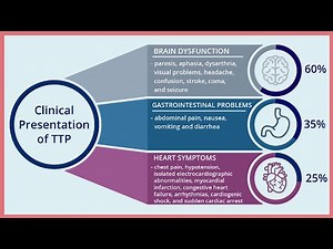 Present Signs and Symptoms and Confirming Diagnosis of TTP