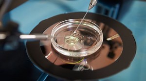 Explain it to me: Fertility