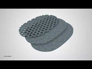 3M™ V.A.C. Veraflo Cleanse Choice™ Dressing - MOA - Descriptive Video