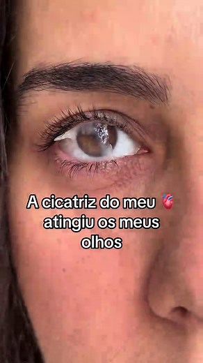 Regencel: Pomada Oftálmica para Olhos e Coração