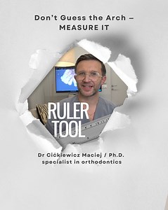 📏 Arch Width Measurement — From Data to Precise Treatment Planning 🦷✨ When we want to measure the arch width, we can use the tools available in ClinCheck or external software. This measurement is especially useful before ordering the Invisalign Palatal Expander or when planning a full aligner treatment. 📊 We display a table and observe the arch widths at specific segments: — between canines, premolars, and molars, shown as INITIAL, ALIGN FINAL, and DOCTOR FINAL. 📐 We can also use the ruler t