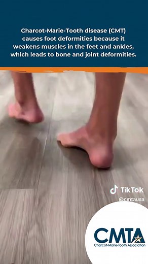 Understanding Charcot-Marie-Tooth Disease (CMT)