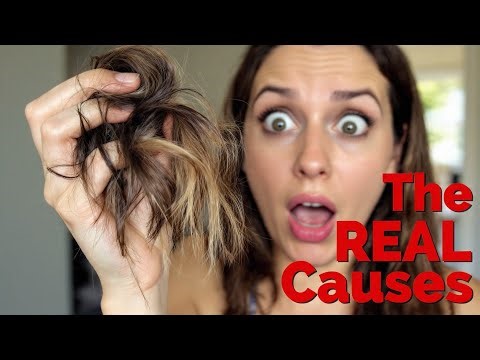 Main Causes of Hair Loss in Women